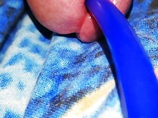  inserting silicone into the urethra