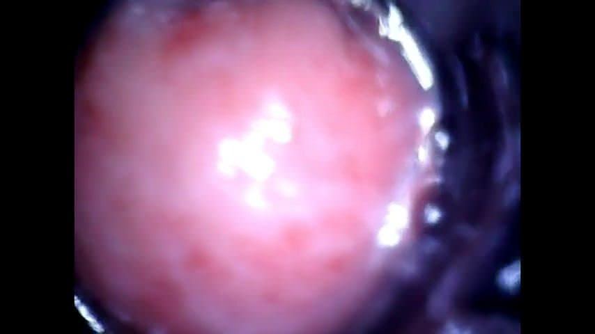 Anal Camera Insertion - Endoscope camera inside my ass - Ass for all, Mobiles, Most Viewed -  MobilePorn