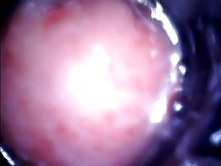 Endoscope Anal, Anal, Analed, Doctor