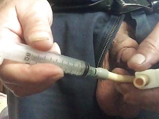 30FR CATHETER REMOVAL And CUMSHOT