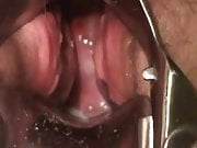  bbw masturbate with speculum show cervix contracting orgasm