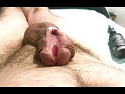 Subincision close up