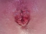 My Hole