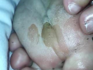 To hot sweaty feet