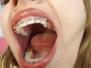 Webcam, Mouth, Close up, In Mouth