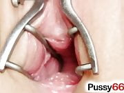 Czech slut Bella Morgan pussy open with vagina retractor