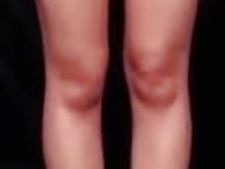 Heres A Close Up Of Misos Legs...