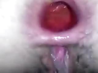 Gaping, Analed, Anal, Gape